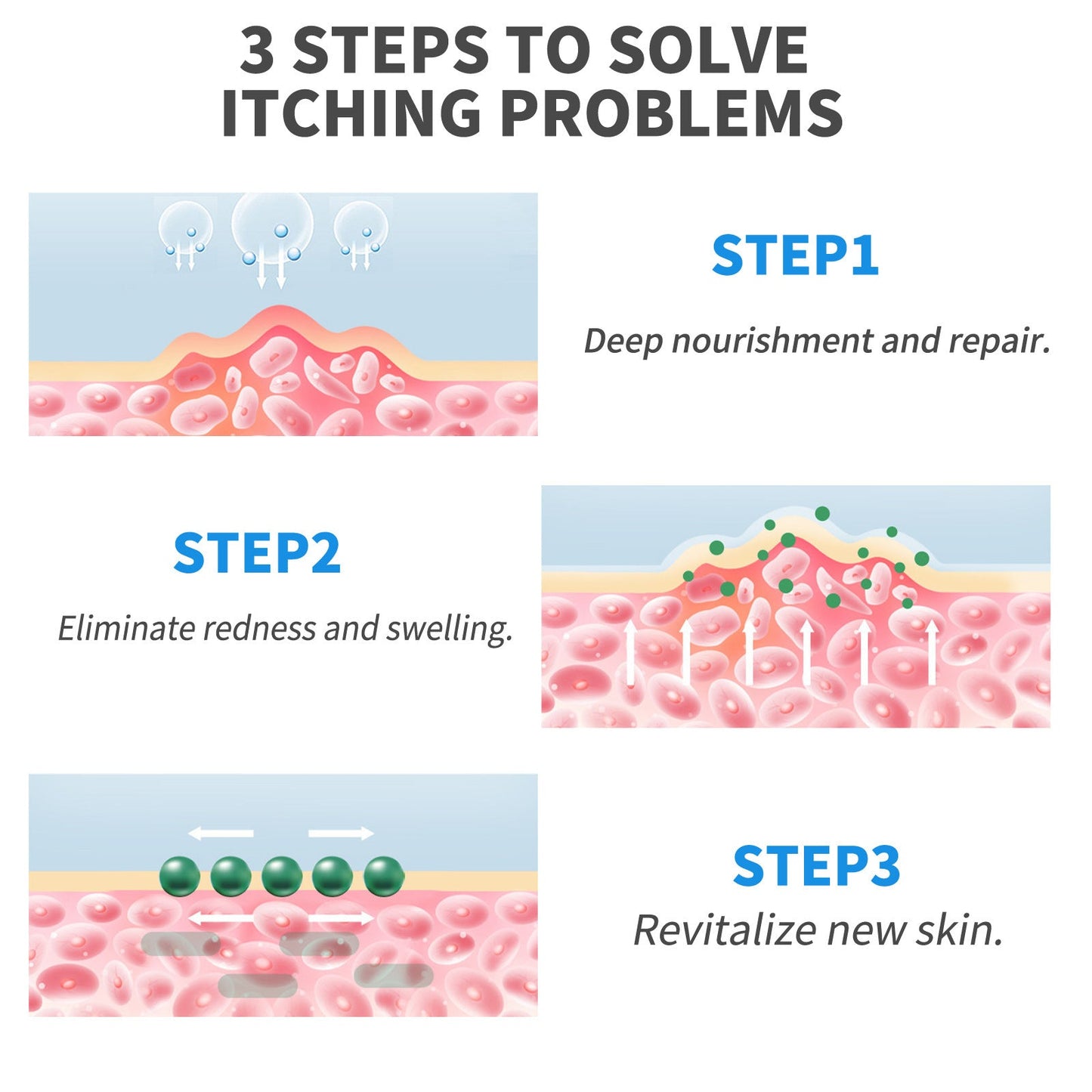 Huidverzorgingsolie met etherische olie voor eczeem psoriasis en jeuk