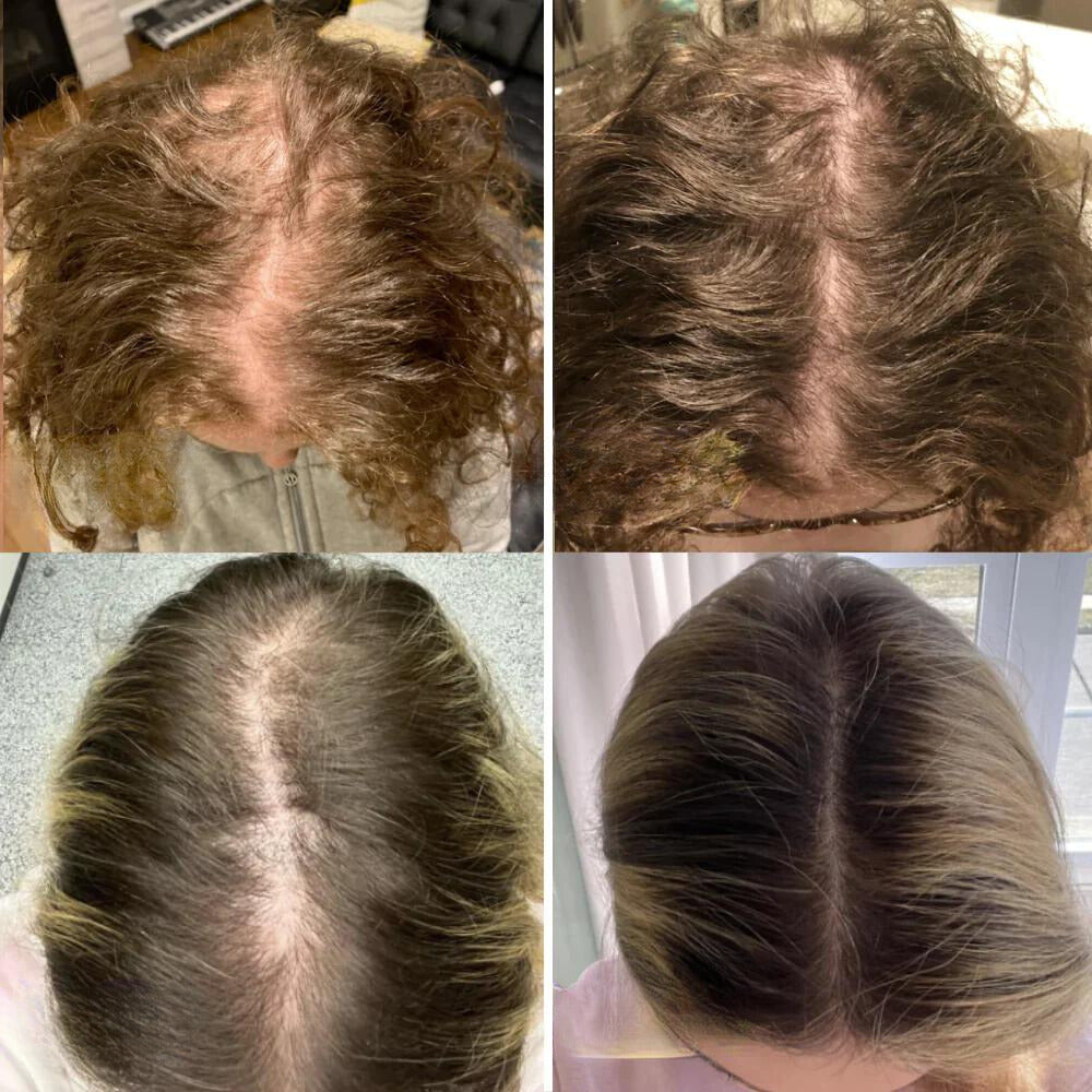 Natuurlijke Haarolie – Stimuleert Haargroei en Vermindert Uitval | Dikker en Sterker Haar - Unisex
