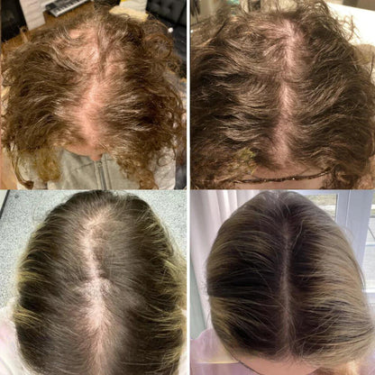 Natuurlijke Haarolie – Stimuleert Haargroei en Vermindert Uitval | Dikker en Sterker Haar - Unisex