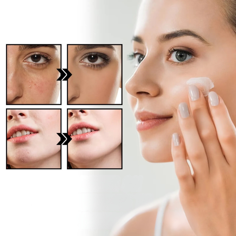CalmAura Herstelcrème 50ml – Kalmerend & Hydraterend voor Gevoelige Huid