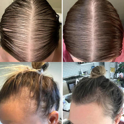 Natuurlijke Haarolie – Stimuleert Haargroei en Vermindert Uitval | Dikker en Sterker Haar - Unisex