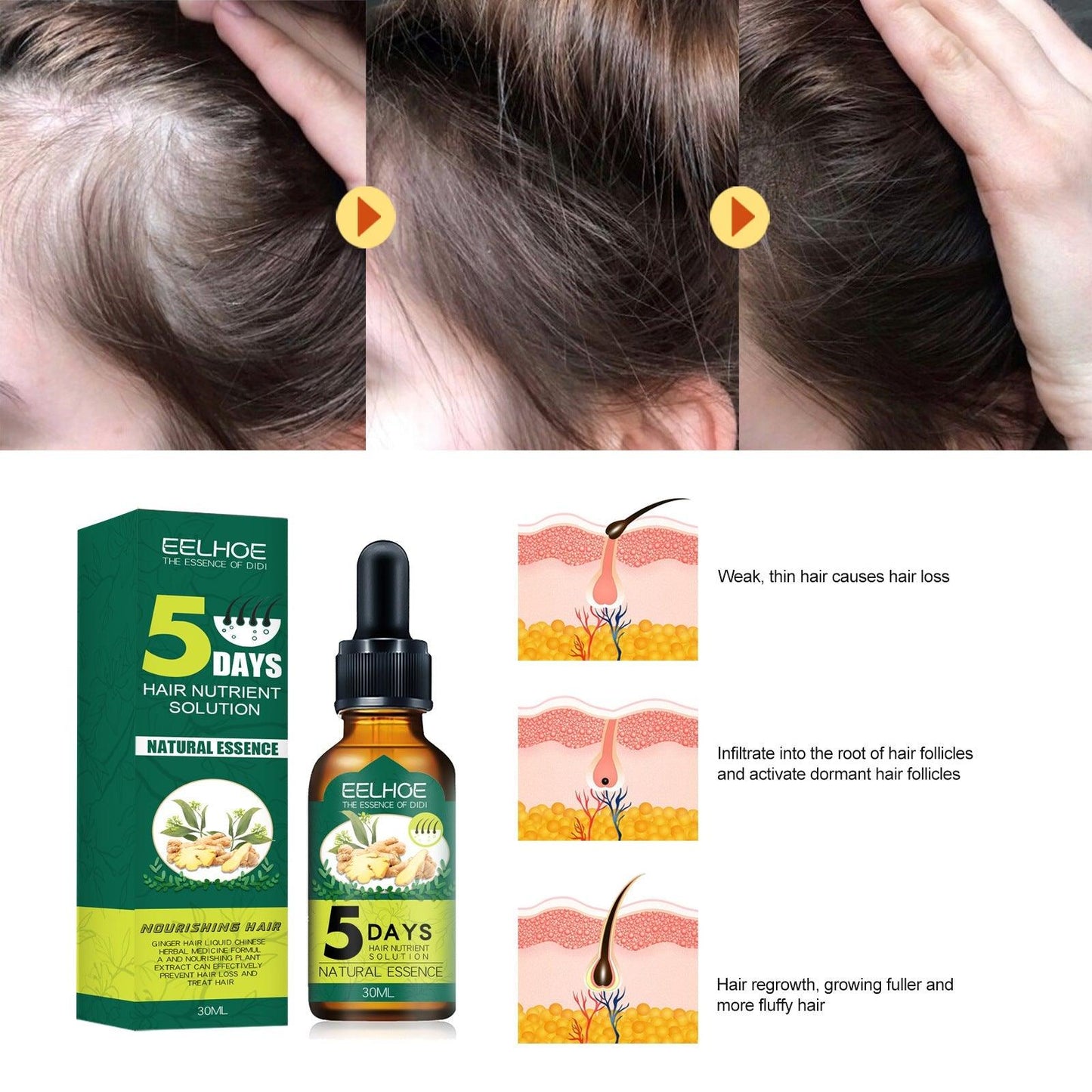 Haarolie met gember essentiële olie voor haargroei bij alopecia en haaruitval 30 ml