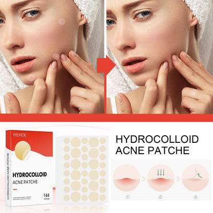 Acnepleisters hydrocolloïde onzichtbaar voor onder make-up tegen puistjes