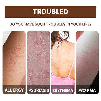 Huidverzorgingsolie met etherische olie voor eczeem psoriasis en jeuk