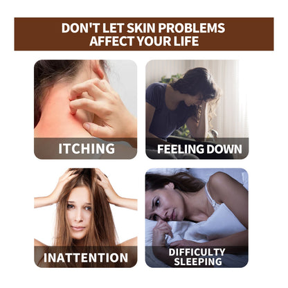 Huidverzorgingsolie met etherische olie voor eczeem psoriasis en jeuk