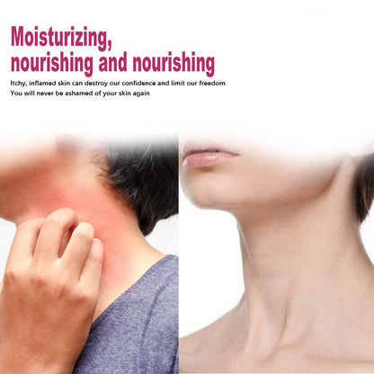 Anti-jeuk crème voor lichaam, handen en voeten 50 g