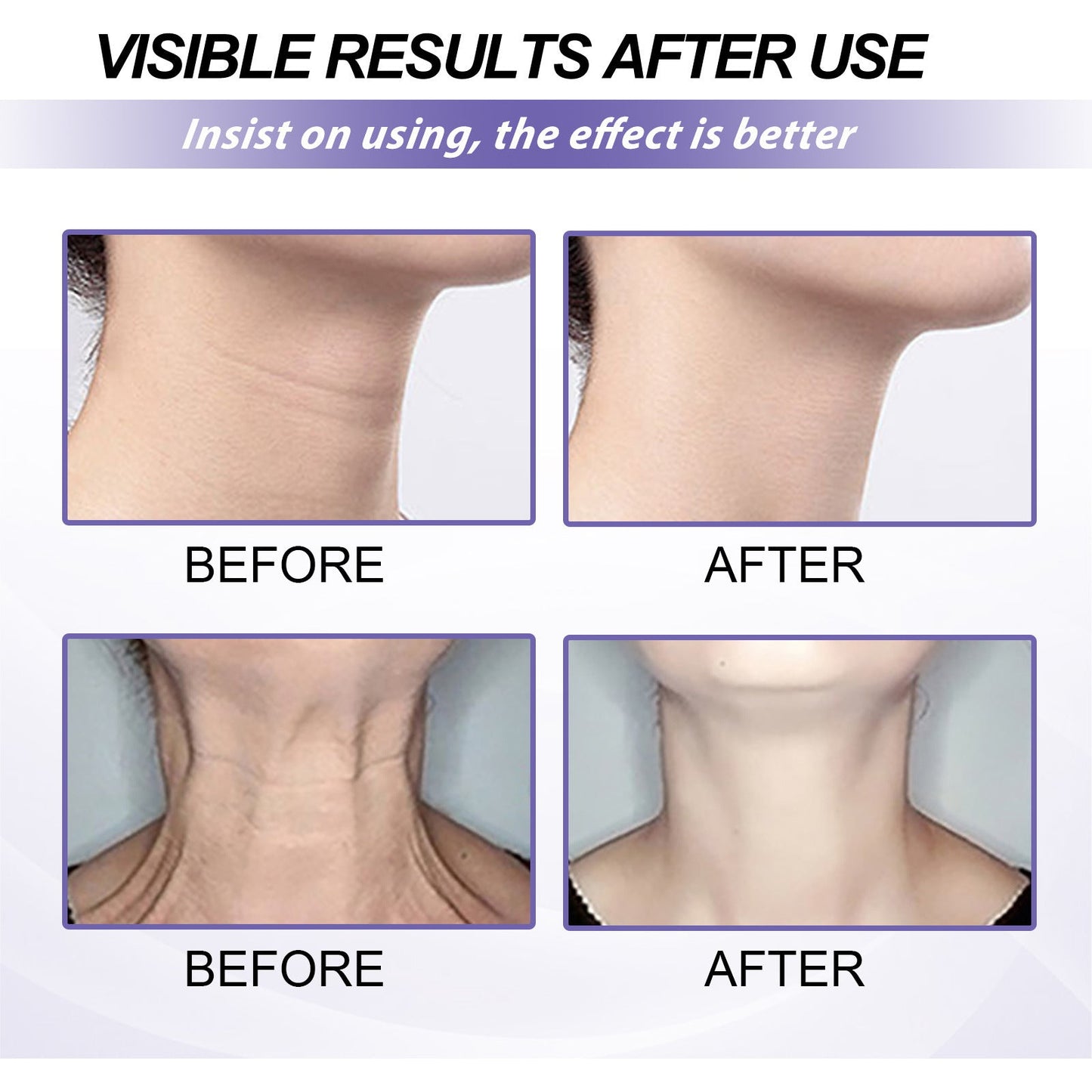 Halscrème met retinol voedend en verstevigend voor halslijnen en de huid van de hals