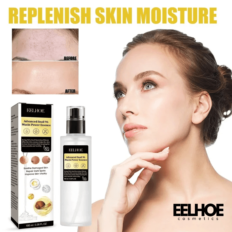 Gezichtsserum met 96% slakkenslijm tegen acne, donkere vlekken en fijne lijntjes