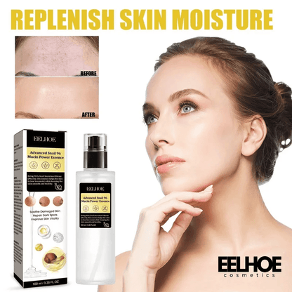 Gezichtsserum met 96% slakkenslijm tegen acne, donkere vlekken en fijne lijntjes